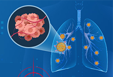 源井KO细胞系助力HER2阳性肺癌治疗新策略开发