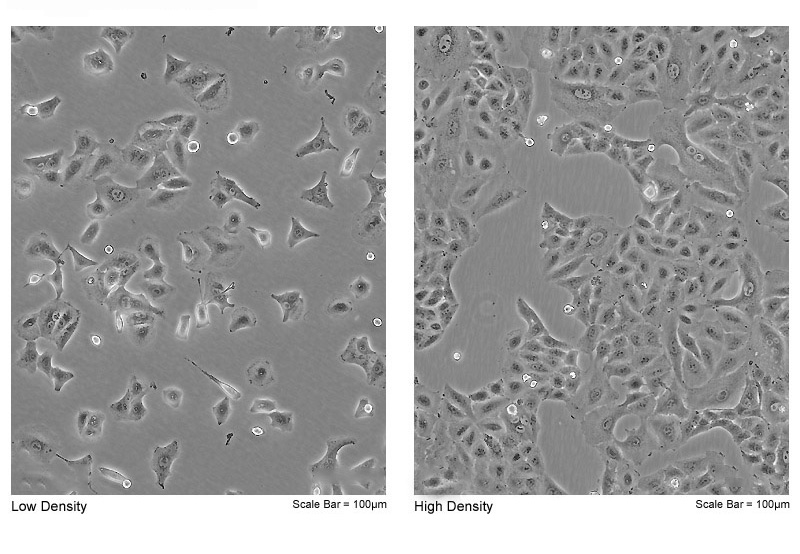 人非小细胞肺癌细胞(A549-EGFP) EGFP荧光蛋白验证