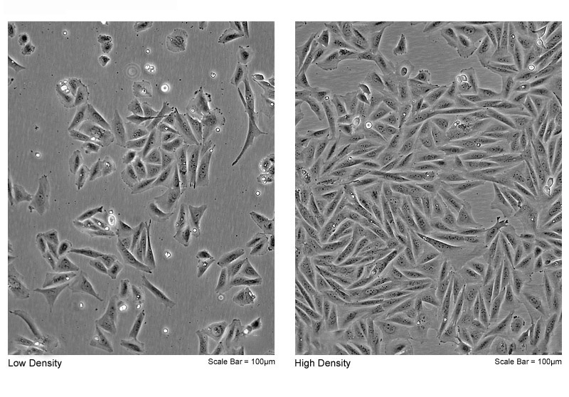 人成骨肉瘤细胞(Saos-2-EGFP) EGFP荧光蛋白验证